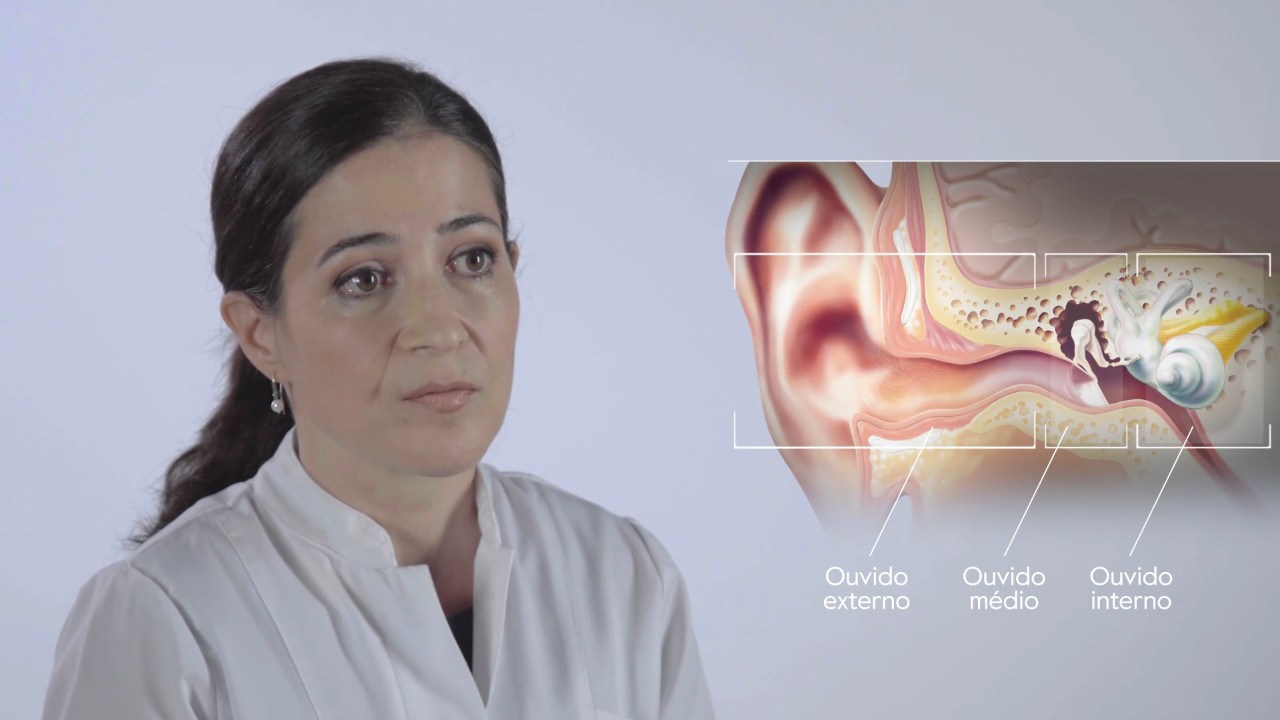 Drª Carla Gapo - tipos de perda auditiva